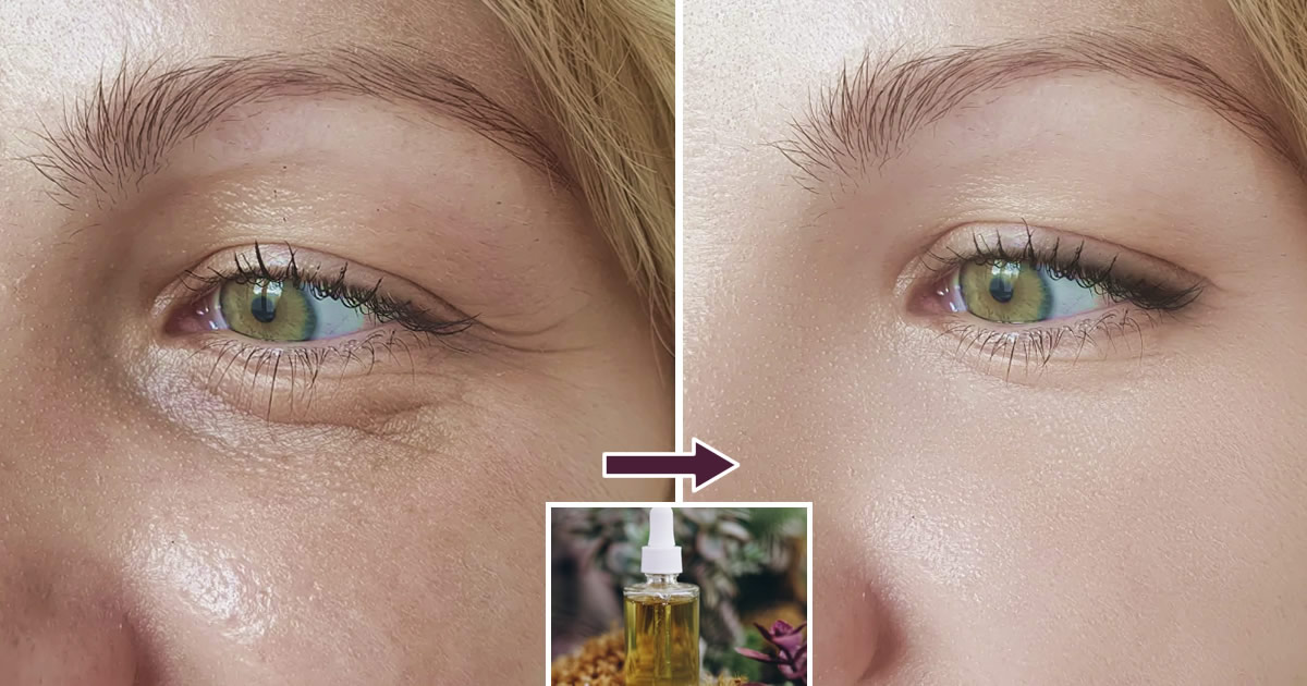 4 straffende Öle, die die Haut „dehnen“ und Falten kaschieren